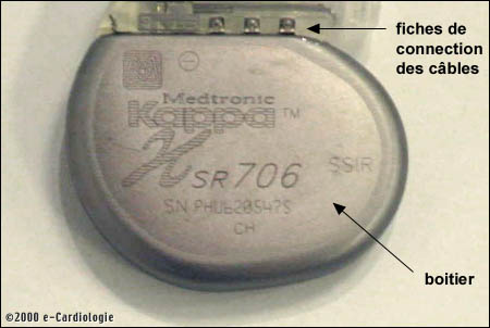 Le botier d'un stimulateur cardiaque